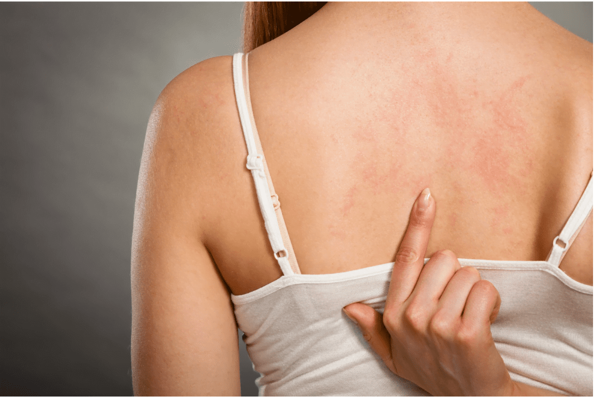 Top 5 afecțiuni dermatologice frecvente