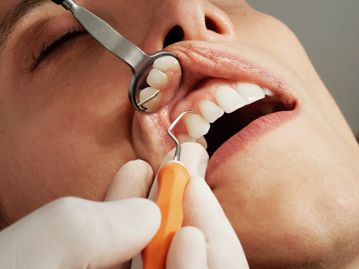Cele mai importante patru motive pentru care un implant dentar te va ajuta sa fii mai fericit