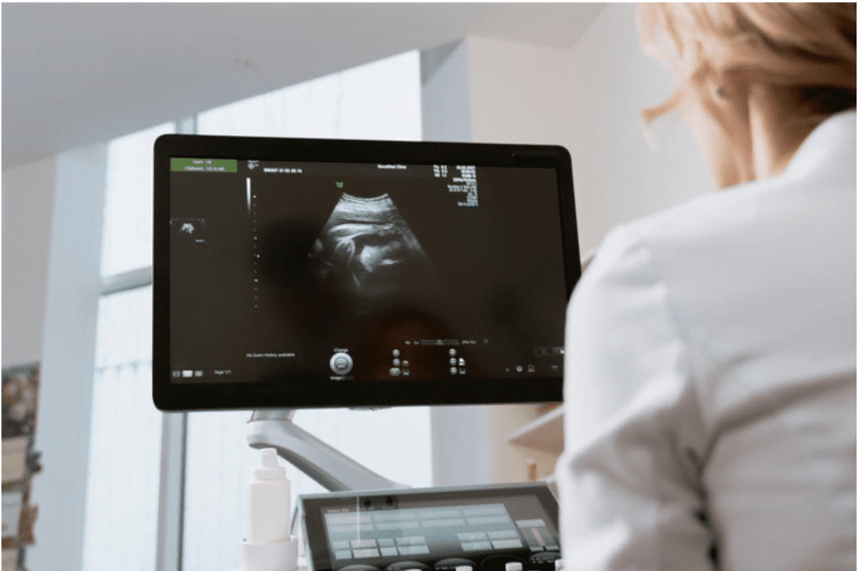 Embolizarea fibromului uterin: Cum se realizeaza si cum te pregatesti de procedura